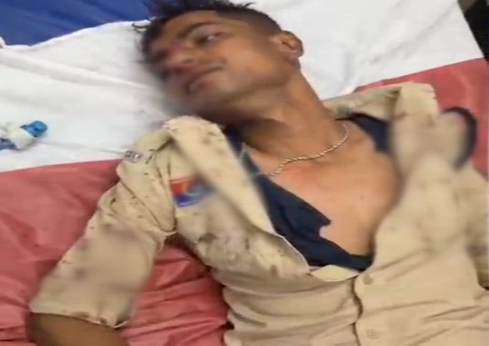 डायल-112 के आरक्षक पर हमला, नशे में धुत युवक ने डंडे से किया वार, जवान घायल